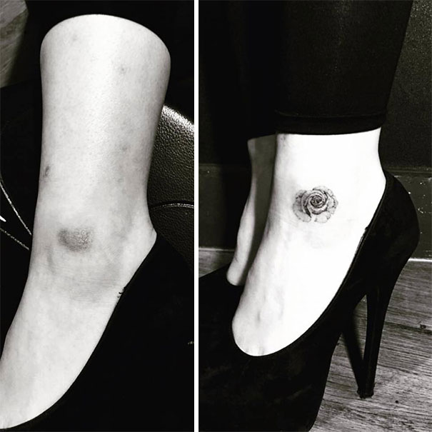 Illustration de l'article : 30 amazing tattoos that turn scars into works of art