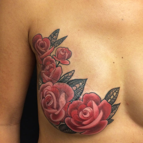 Illustration de l'article : 30 amazing tattoos that turn scars into works of art