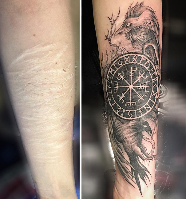 Illustration de l'article : 30 amazing tattoos that turn scars into works of art
