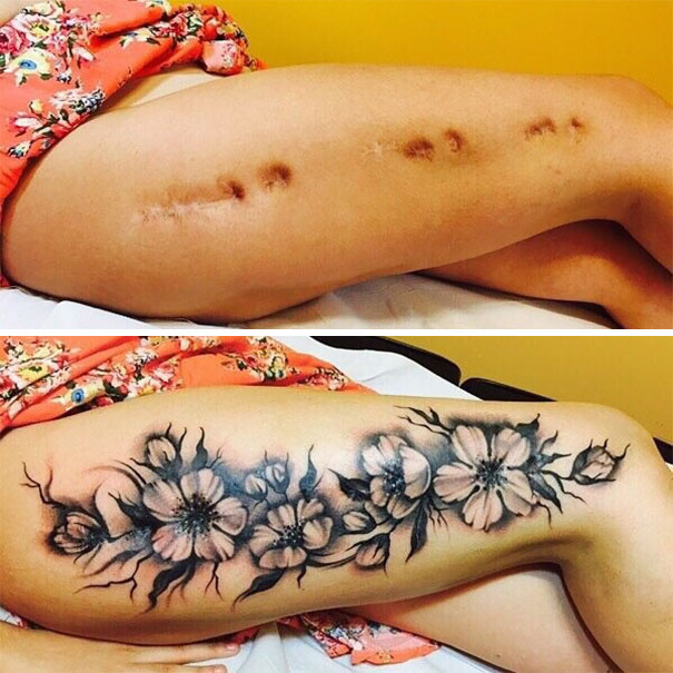Illustration de l'article : 30 amazing tattoos that turn scars into works of art
