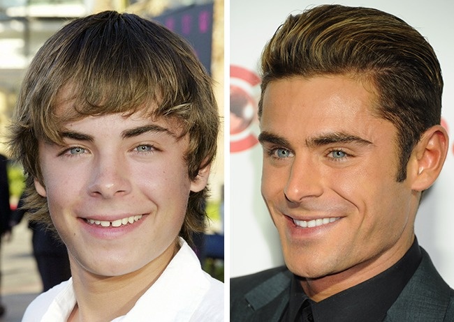 Illustration de l'article : 15 celebrities restyled by Hollywood: before and after photos