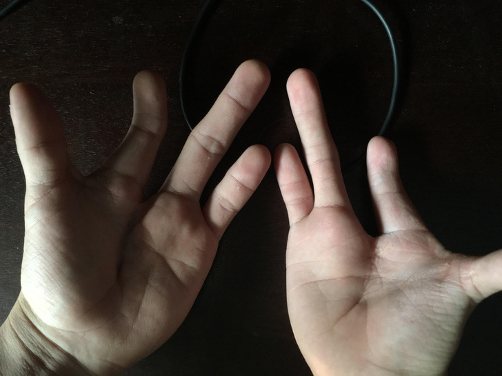 Illustration de l'article : 18 photos of unusual physical traits and natural wonders