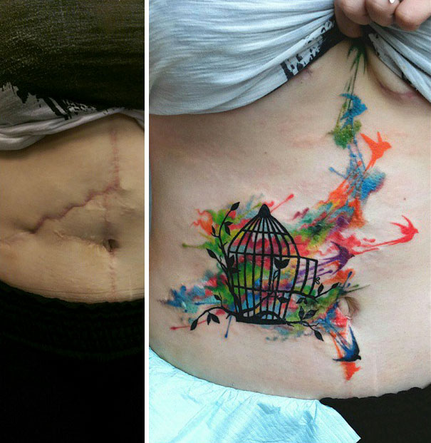 Illustration de l'article : 30 amazing tattoos that turn scars into works of art