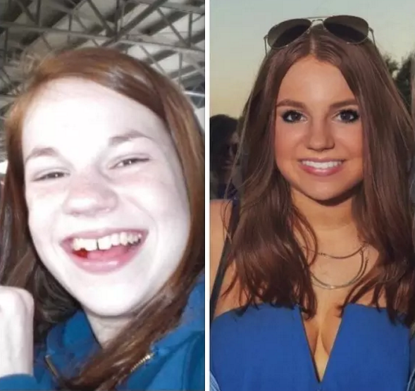 Illustration de l'article : 36 remarkable photos of people who blossomed once they passed puberty