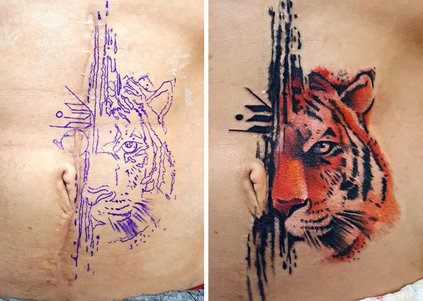 Illustration de l'article : 30 amazing tattoos that turn scars into works of art
