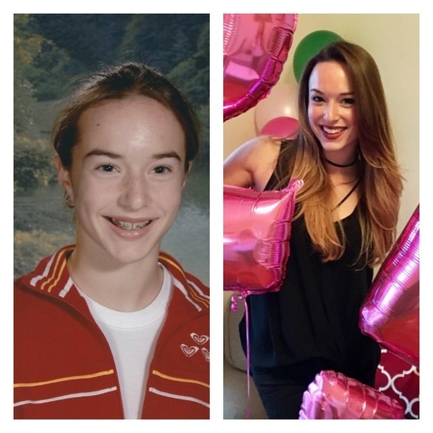 Illustration de l'article : 36 remarkable photos of people who blossomed once they passed puberty
