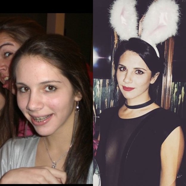 Illustration de l'article : 36 remarkable photos of people who blossomed once they passed puberty